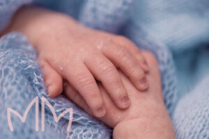 Atendimento Dermatologia Pediátrica em Santo Antônio da Platina e região. Dra. Mariana Magalhães Dermatologista