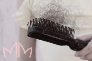 Tratamento de Eflúvio pós covid em Santo Antônio da Platina e região. Dra. Mariana Magalhães Dermatologista