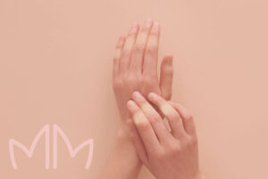 Tratamento de Esclerodermia em Santo Antônio da Platina e região. Dra. Mariana Magalhães Dermatologista