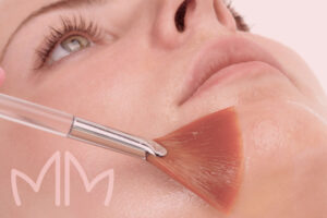 Procedimento de Peelings Faciais em Santo Antônio da Platina e região. Dra. Mariana Magalhães Dermatologista