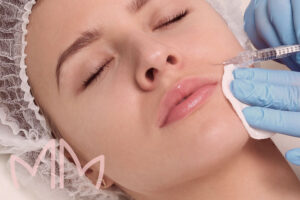 preenchimento com acido hialuronico - Hidratação Profunda em Santo Antônio da Platina e região. Dra. Mariana Magalhães Dermatologista