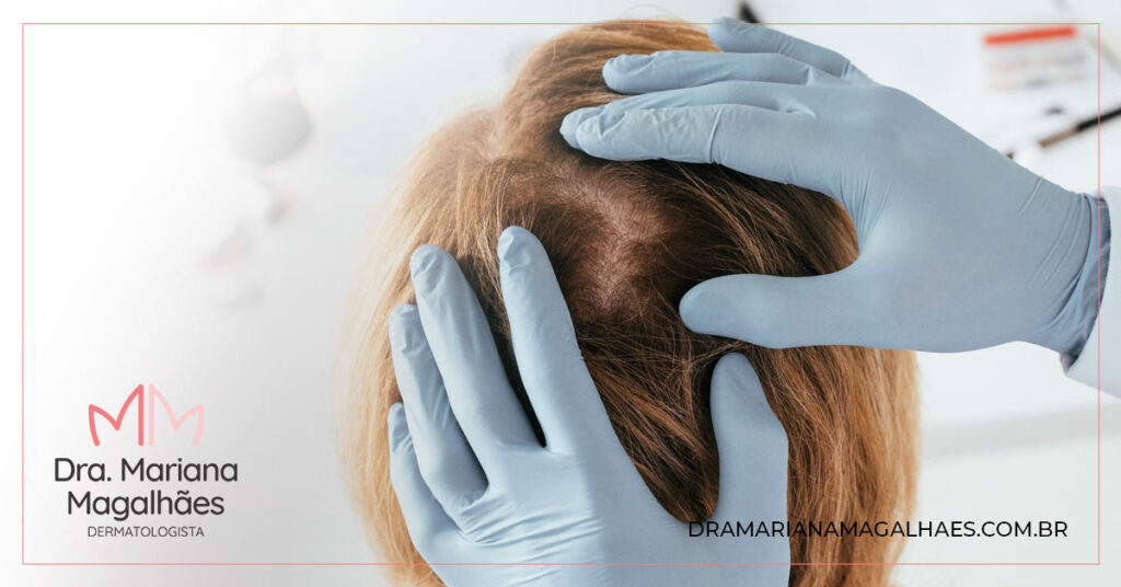 Dermatologista analisando um paciente com psoríase couro cabeludo