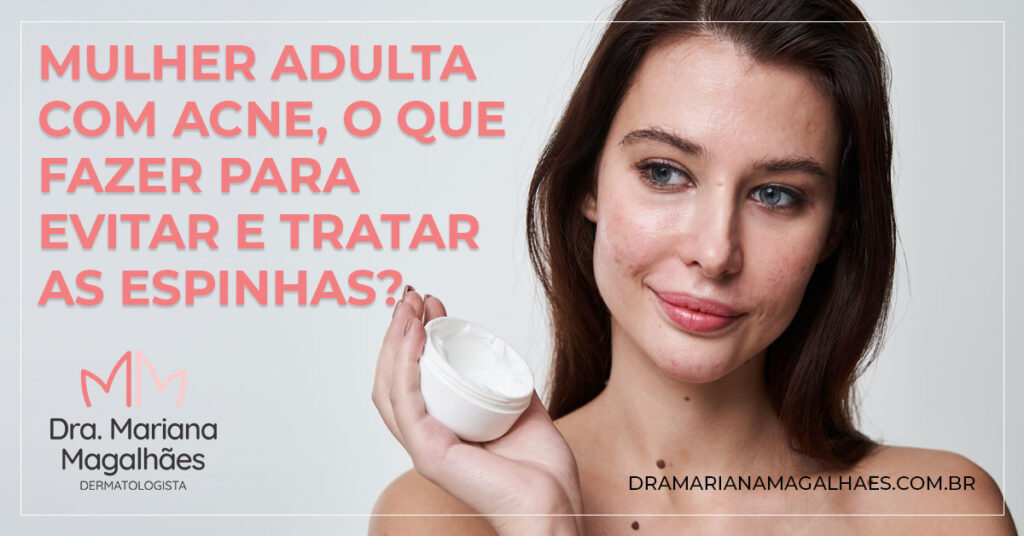 Mulher adulta com acne, o que fazer para evitar e tratar as espinhas?